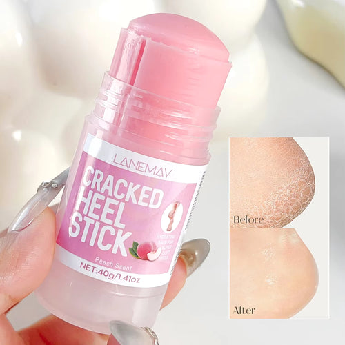 Baume Hydratant Pieds – Soin Nourrissant et Réparateur