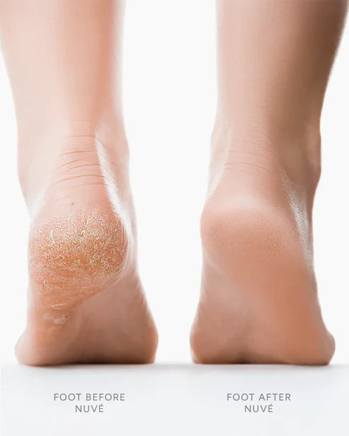 Râpe Électrique pour Pieds – Soin Doux et Résultat Rapide